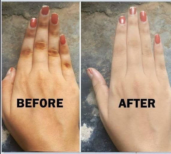 Full Body Lightening Package(6pc set)
