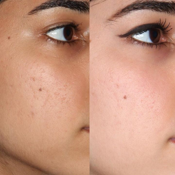 Full Body brightening Package (2 shades lighter) 7 pack set